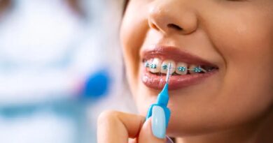 How To Maintain Oral Hygiene With Invisalign Braces