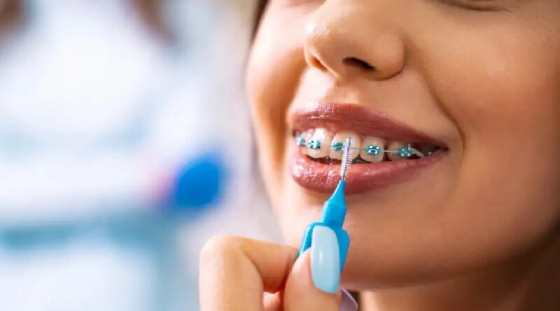 How To Maintain Oral Hygiene With Invisalign Braces